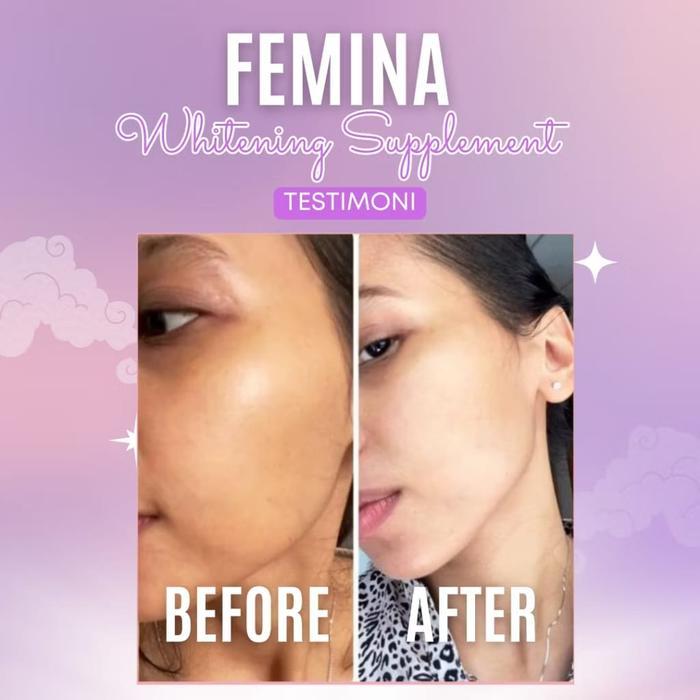 Promo Paket 3 Botol + 1 Botol Femina Pemutih Badan Whitening Femina Whitening Supplement Original