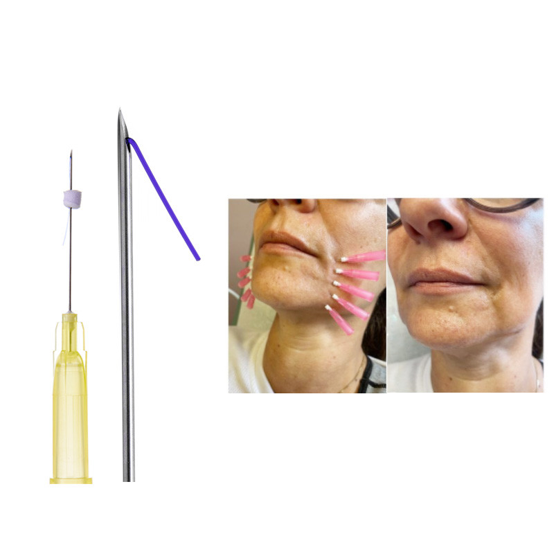 Medical Grade Pdo Thread Mono 20pcs/bag Pdo Multi Threads For Face Neck Beauty Lifting Hilos Pdo
