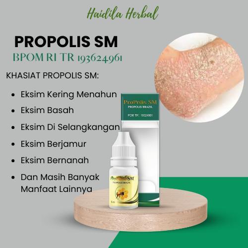 Obat Eksim Kering Menahun, Obat Eksim Kering, Obat Gatal Eksim