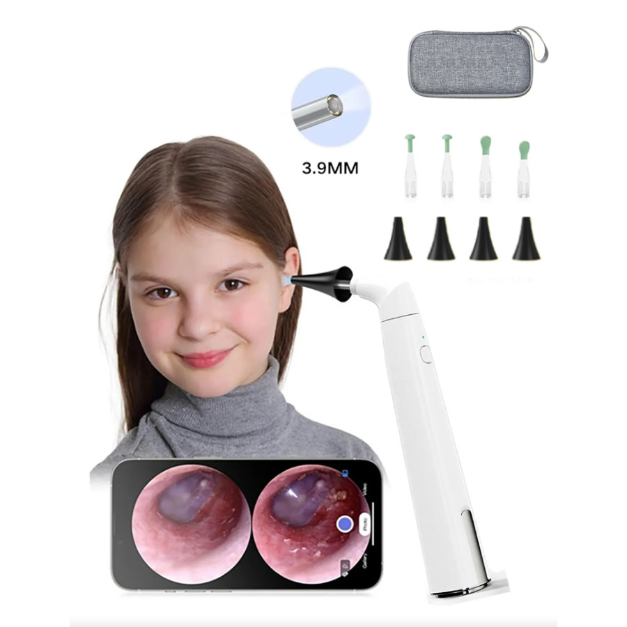 Visual Ear Scoop Endoscope Wifi Wireless Otoscope Ear Wax Removal 3.9Mm 720P Taking Picture Video
