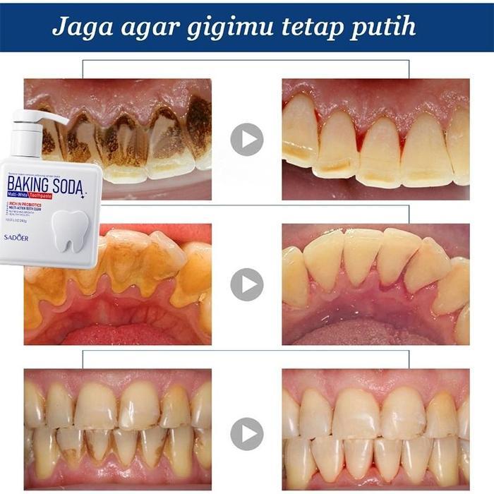 Maria - Odol Pemutih Gigi Dan Karang Gigi Penghilang Karang Gigi Pembersih Karang Gigi 300Ml Alat
