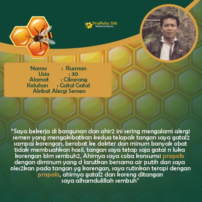 ZiZa- Selangkangan Hitam Dan Gatal, Selangkangan Berjamur, Salep Jamur Selangkangan Gatal,