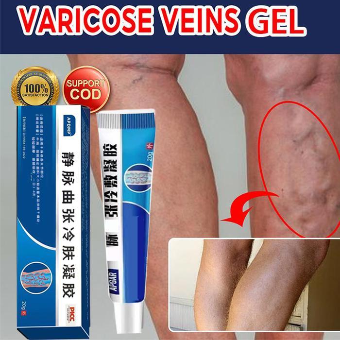 CODVaricose Veins Cream pembesar veins ampuh Obat varises di kaki dan betis paling ampuh Obat