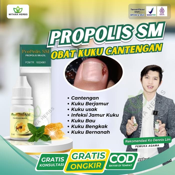 Pilihan- Propolis Sm Obat Cantengan Kuku Berjamur Infeksi Jamur Kuku Cantengan Kuku Bengkak