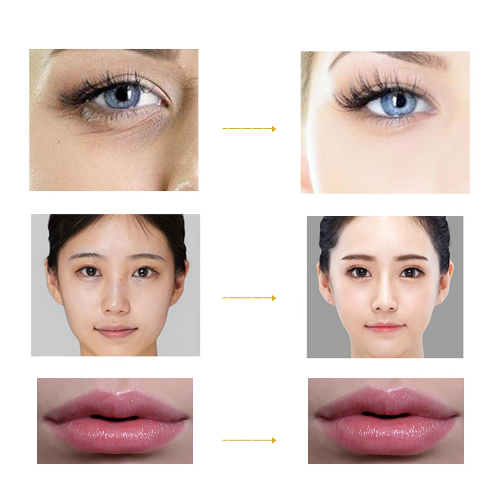 2 In 1 Hyaluron Pressurized Pen Lip Filler Injections Hyaluronic Acid Tools Hialuron Pen