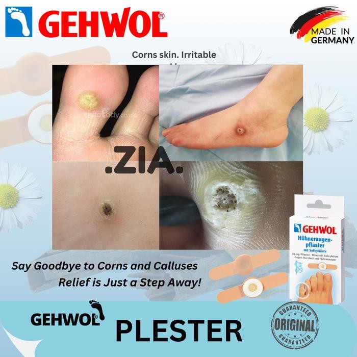 Terlaris GEHWOL KORNEA SKIN TINCTURE KAPALAN MATA IKAN PLESTER CALLUS PLASTER SALE