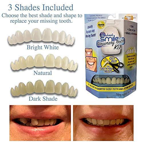 Penambal Gigi Ompong Gigi Gingsul Instant Smile Temporary Tooth Kit
