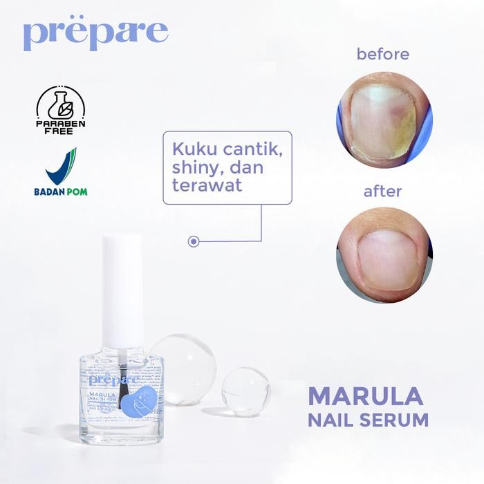 benta- Perawatan Kuku Cantengan Vitamin Kuku Obat Kuku Rusak Serum Kuku Dan Tangan Obat