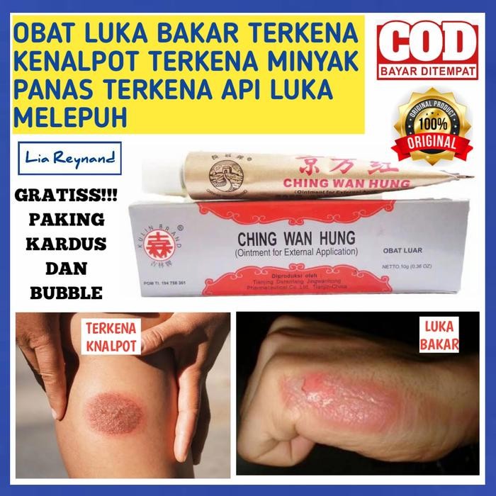 Ready OBAT LUKA BAKAR TERKENA KENALPOT TERKENA MINYAK PANAS TERKENA API