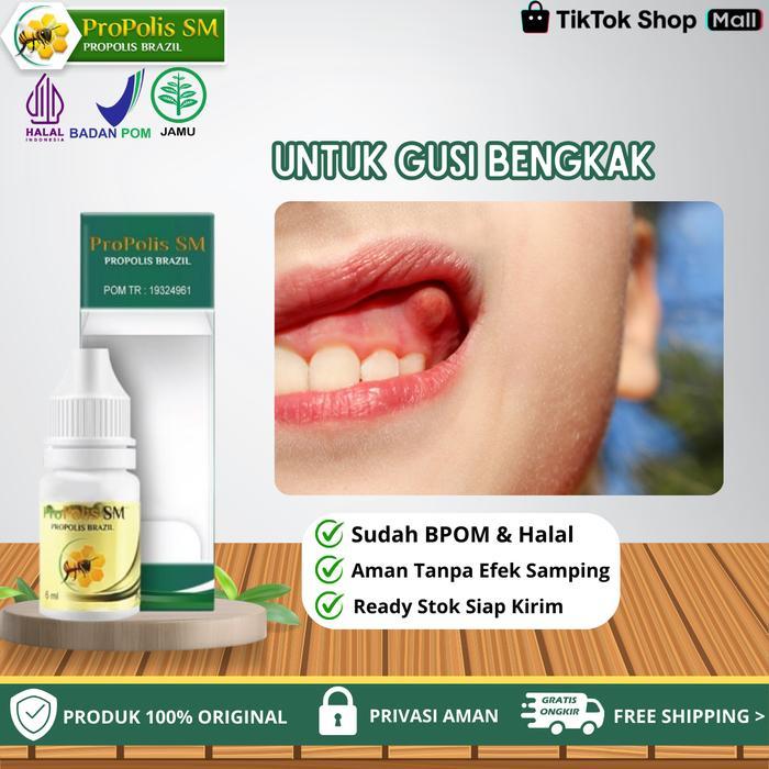 Propolis SM - Untuk Pengempis Gusi Bengkak Abses Gusi / Abses Gigi Anak / Dewasa
