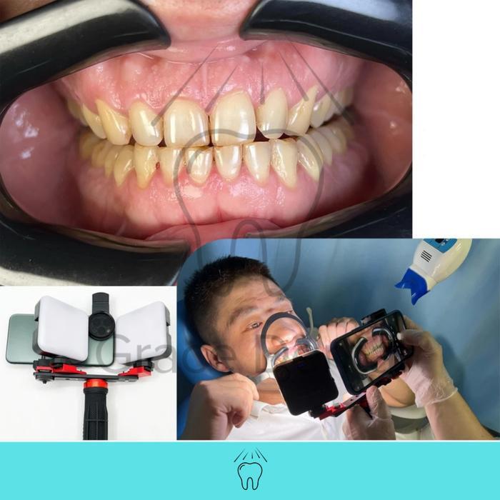 Lampu Led Dental Photography Fotografi Ready