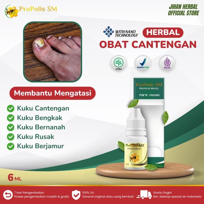 jsur- Propolis Sm Obat Cantengan Jempol Kaki Dan Tangan Perawatan Kuku Bengkak Bernanah