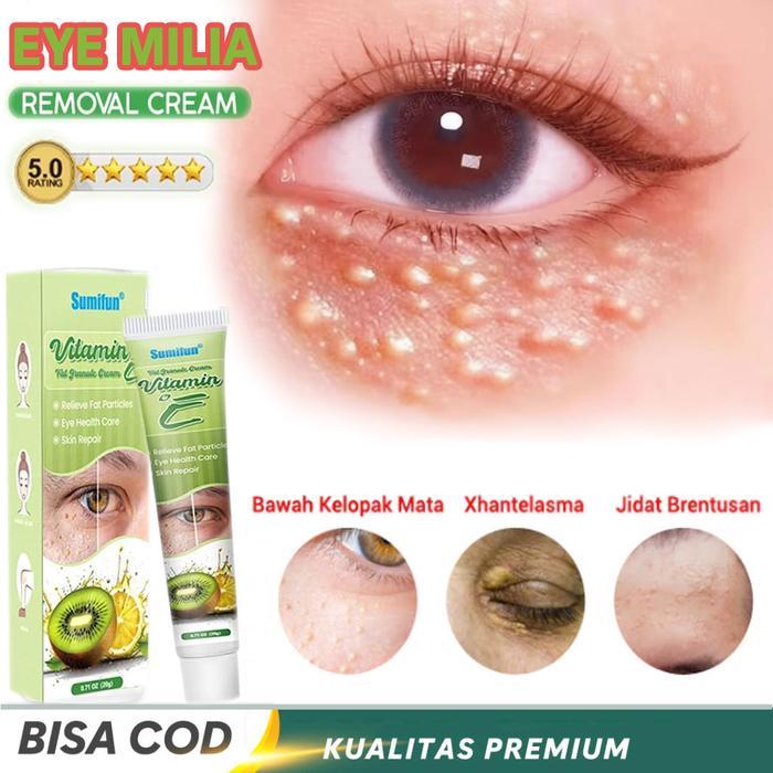 COD krim penghilang milia syringoma xanthelasma butiran lemak sekitar mata