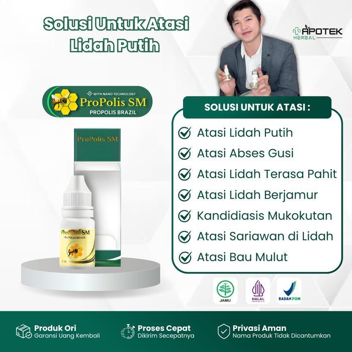 Propolis SM Untuk Lidah Putih Terasa Pahit Radang Lidah Sariawan Lidah Berjamur Kandidiasis