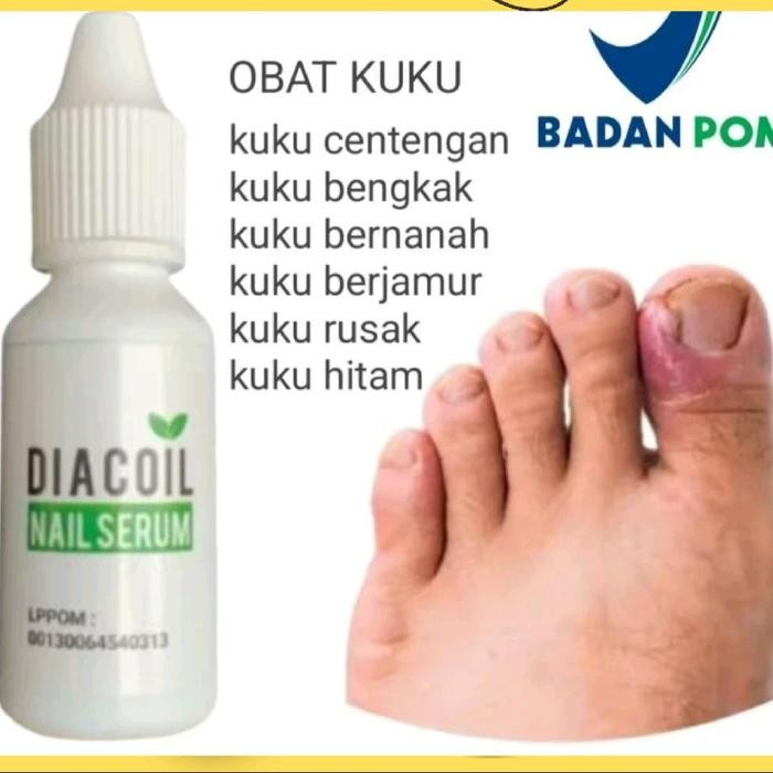 Pilihan- Serum Kuku Rusak Diacoil Nail Serum Original Obat Jamur Kuku Cantengan Dan Bernanah