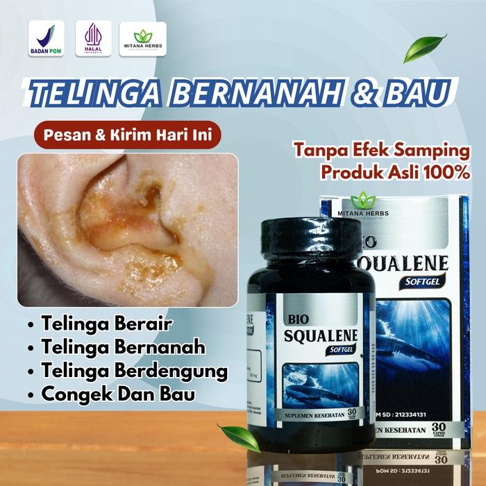 Chocolatoslatoe Bio Squalene Telinga Berair Bernanah Berdengung Congek Dan Bau Ear Kuping