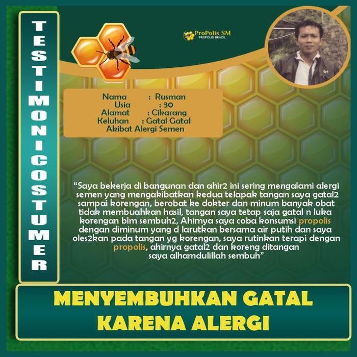 Propolis Sm Suplemen Kesehatan Untuk Jerawat Punggung Biang Keringat Gatal Ruam Merah Beruntusan