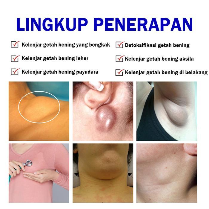 Baru Salep Tiroid Di Leher 20g - Krim Tiroid Herbal Ampuh Atasi Gondok, Hipertiroid, Benjolan Leher