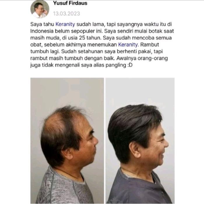 Keranity Serum Penumbuh Rambut Atasi Rontok Kebotakan Asli Original Terlaris