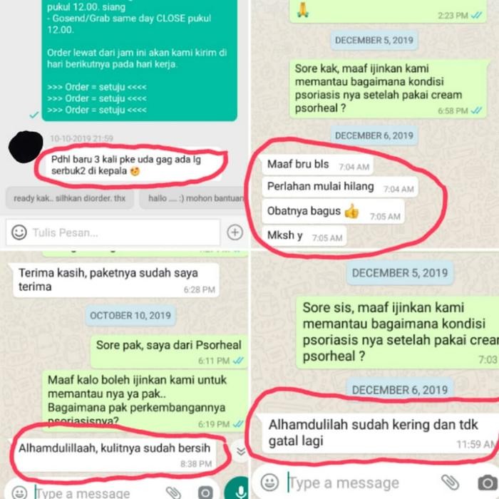 Paket Cream Tanpa Shampo Ketombe Parah Psoriasis Scalp Psorheal Israel