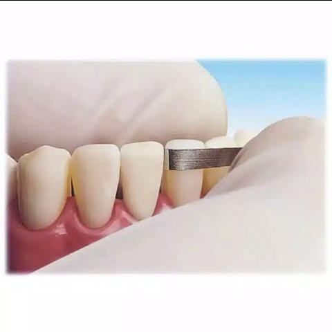 Terlaris slicing ortho horico grinding steel strips kikir gigi manual dental ab SALE