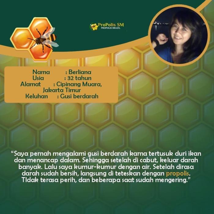 Maria - Propolis Sm - Untuk Pengempis Gusi Bengkak Abses Gusi / Abses Gigi Anak / Dewasa