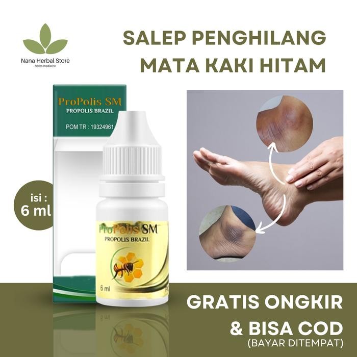 Pemutih Mata Kaki Hitam, Salep Penghilang Kaki Kapalan, Solusi Atasi Kaki Pecah-Pecah Dan Kering,