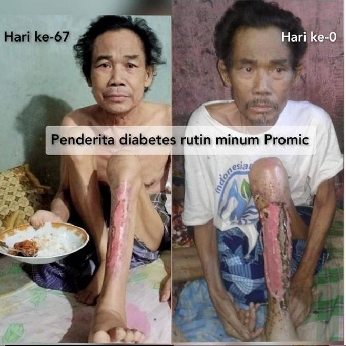 PROMIC PROBIOTIC MICROBS/BIANG/STARTER NANAS 200ML