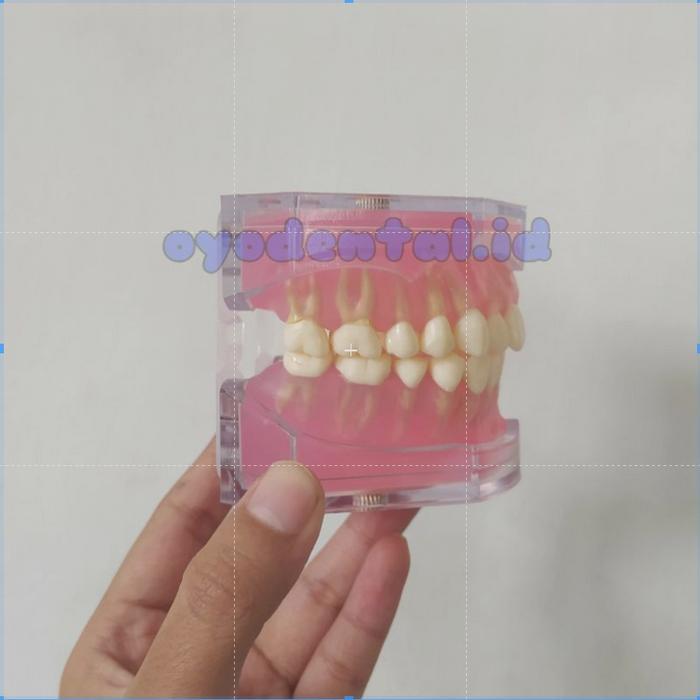 dental model study gigi lepasan / model gigi lepasan / phantom pantum