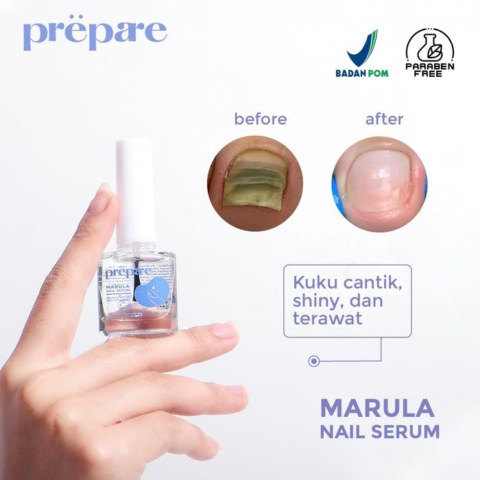 Sale Perawatan Kuku Cantengan Vitamin Kuku Obat Kuku Rusak Serum Kuku dan Tangan Obat Cantengan