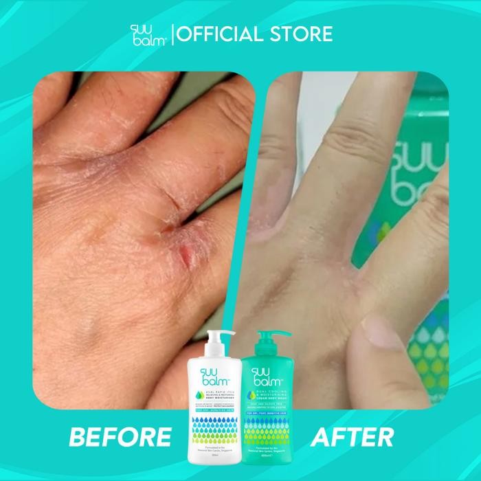 5mr0- Adult Body Care Pack - Suu Balm Dual Cooling & Moisturising Cream Body Wash (420Ml) &