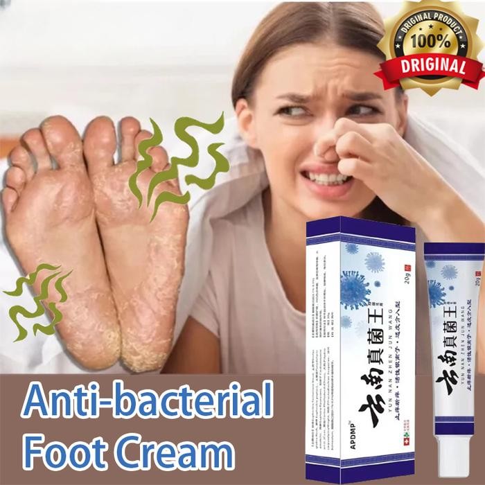 Pilihan- Obat Kaki Rayapan Telapak Kaki Bolong Pecah Pecah Korodok Kutu Air Rorombeheun Mata