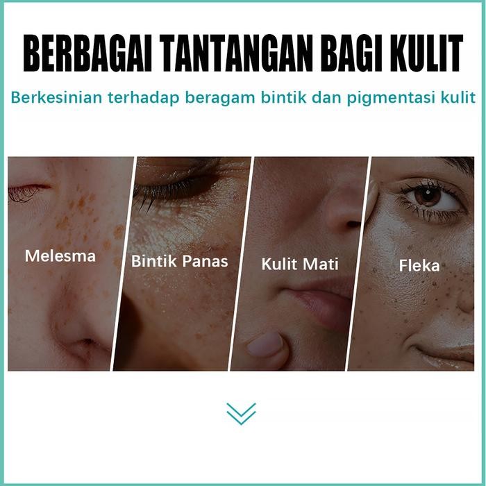 Krim Penghilang Flek Hitam Efektif Krim Pemutih Flek Bintik Melasma Penghapusan Salep Flek Hitam