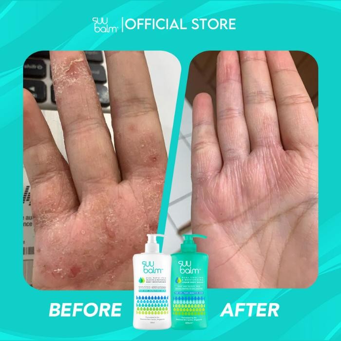 benta- Adult Body Care Pack - Suu Balm Dual Cooling & Moisturising Cream Body Wash (420Ml) &