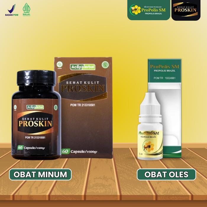 [PAKET COMBO] - Propolis SM & Proskin Untuk Gatal Kulit Ruam Merah di K3lamin dan Sel4ngkangan,