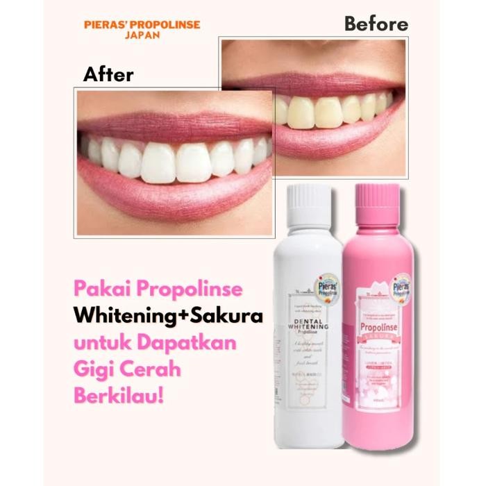 5ops- Pieras Propolinse Sakura Travel Size Mouthwash 150Ml Obat Kumur