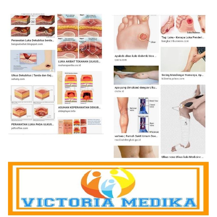 PEMBUNGKUS/PEMBALUT LUKA ULKUS VENA/DEKUBITUS/MERK DUODERM EXTRA THIN