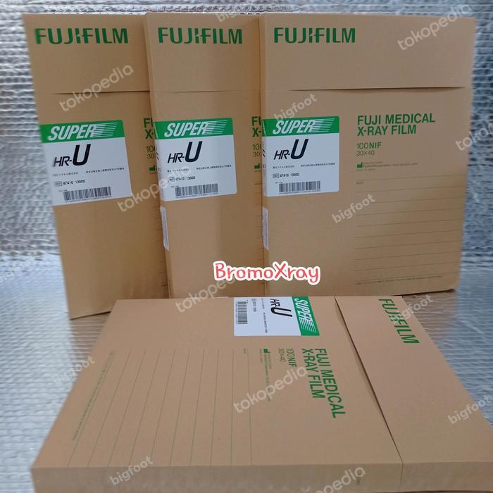 FUJI XRAY FILM SHR-U UK. 30X40 RONTGEN RONSEN RONGSEN RADIOLOGI X RAY