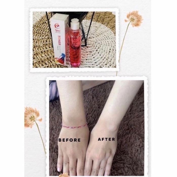 Toner Badan Yoni Skincare Bpom Perontok Daki Pemutih Badan 100 Ml Ori