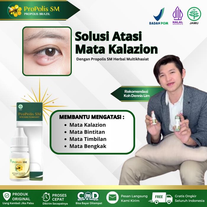 Propolis SM - Obat Mata Kalazion, Mata Bintitan, Mata Timbilan, Kutil Di Kelopak Mata, Mata Bengkak,