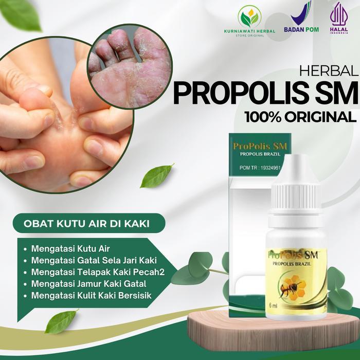 NEW PRODUK OBAT KUTU AIR, GATAL SELA-SELA JARI KAKI, KUTU AIR DI KULIT KAKI, JAMUR KAKI GATAL,