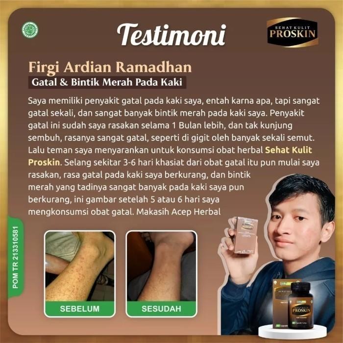 HEMAT Proskin Kapsul Herbal Jamur Kulit Kepala Berkerak, Gatal Kulit Kepala, Kurap, Eksim,