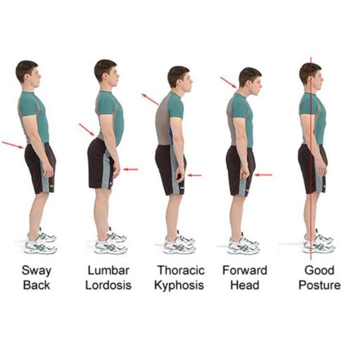 POSTURE CORRECTOR PENEGAK PUNGGUNG POSTUR PENYANGGA PUNGGUNG WANITA
