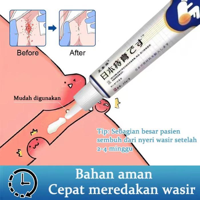 Ready JAPAN Obat wasir Salep wasir Obat hemoroid 20G Salep obat wasir paling efektif Krim Wasir