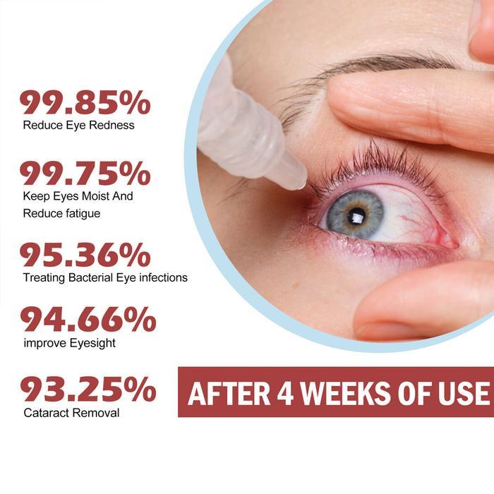 5s79- [Ampuh] Obat Tetes Mata Berlemak Kekuningan Penyakit Pterigium Glukoma Mata Katarak