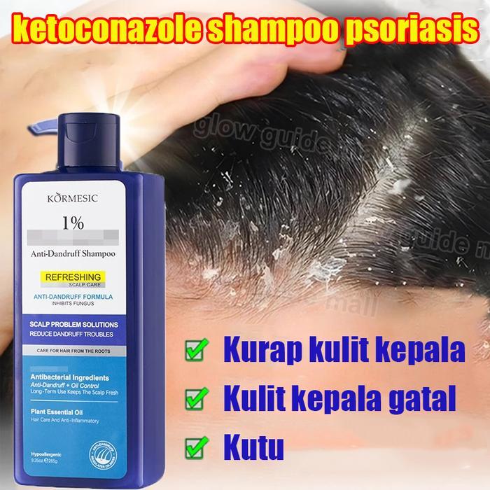 ketoconazole shampoo shampoo psoriasis kulit kepala shampoo anti ketombe anti dandruff penghilang