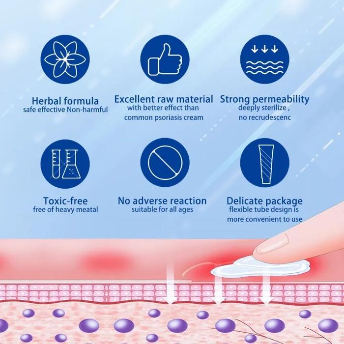 Vitabone- Salep Khusus Psoriasis Ointment - Import - Kurap Pada Kulit Kepala - Kutu Air - Kurap Pada