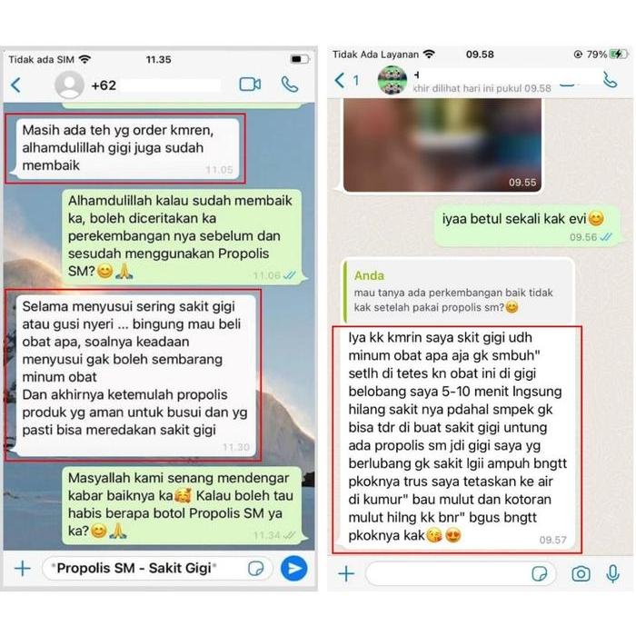 761c- Obat Gusi Turun Herbal - Resesi Gusi - Gigi Turun - Propolis Sm Brazil