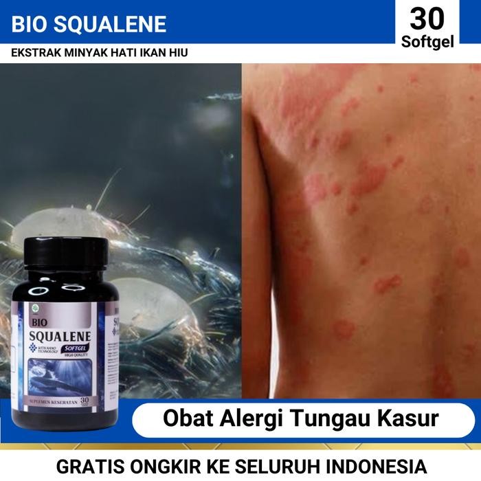 Ready Bio Squalene Obat Alergi Tungau Kasur, Alergi Kutu Kasur, Alergi Tungau Debu, Penghilang Bekas