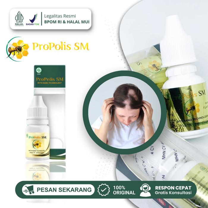 Propolis Penumbuh Rambut Pitak, Atasi Alopecia Areata dan Rambut Rontok